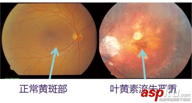 護眼顯示器