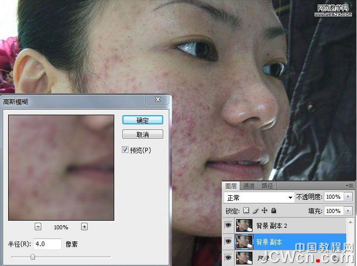 練就網絡美女 ps完美除痘痘磨皮教程_網頁設計