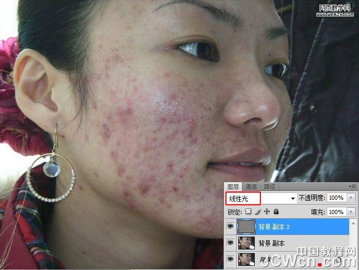 練就網絡美女 ps完美除痘痘磨皮教程_網頁設計