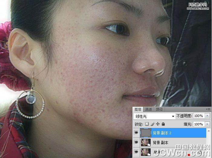 練就網絡美女 ps完美除痘痘磨皮教程_網頁設計