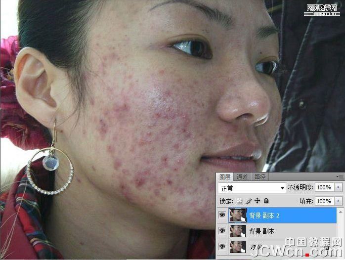 練就網絡美女 ps完美除痘痘磨皮教程_網頁設計